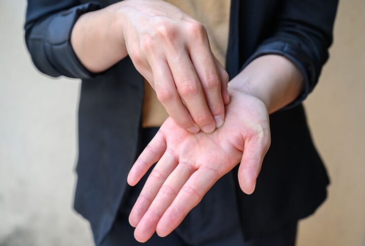 5 Possible Causes of a Purple Finger