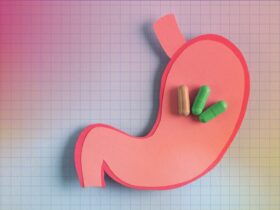 5 Supplements That May Actually Make Constipation Worse