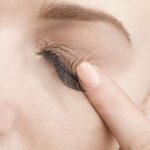 6 Causes of a Rash on Your Eyelid and How to Treat It