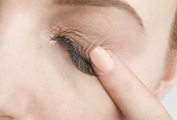 6 Causes of a Rash on Your Eyelid and How to Treat It