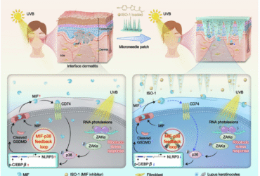 A MIF-p38-GSDMD inflammatory loop in keratinocytes underlies UVB-induced cutaneous lupus