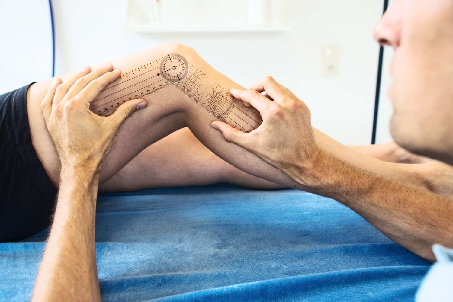 Arthrofibrosis of the Knee: Symptoms, Causes, and More