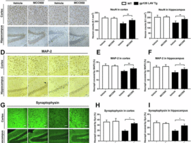 Author Correction: NLRP3-dependent pyroptosis is required for HIV-1 gp120-induced neuropathology