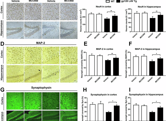 Author Correction: NLRP3-dependent pyroptosis is required for HIV-1 gp120-induced neuropathology