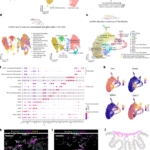 Base barrier cells provide compartmentalization of choroid plexus, brain and CSF