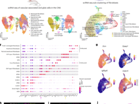 Base barrier cells provide compartmentalization of choroid plexus, brain and CSF