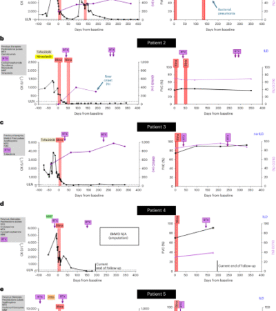 Bispecific T cell engagers for treatment-refractory autoimmune connective tissue diseases