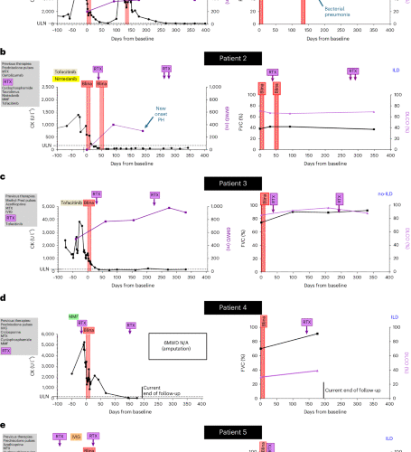 Bispecific T cell engagers for treatment-refractory autoimmune connective tissue diseases