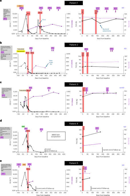 Bispecific T cell engagers for treatment-refractory autoimmune connective tissue diseases