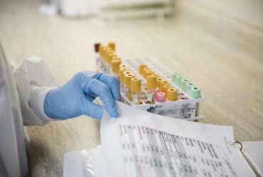 Blood Tests for Celiac Disease