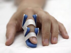 Broken Finger Symptoms and Treatment