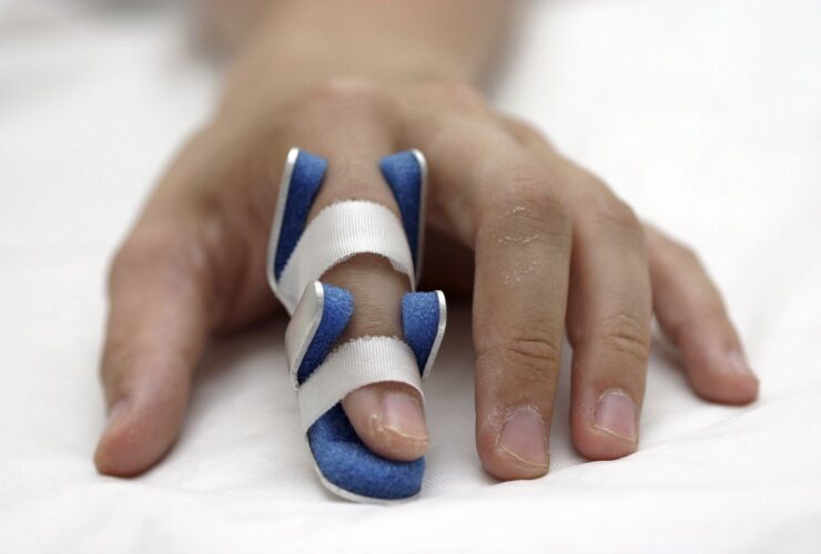 Broken Finger Symptoms and Treatment