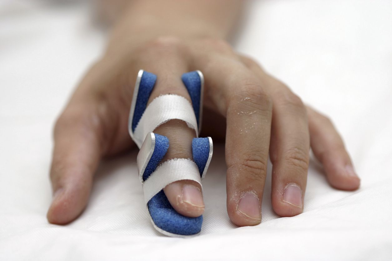 Broken Finger Symptoms and Treatment
