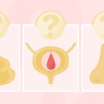 Is This Weird Bleeding a Sign of Cancer?