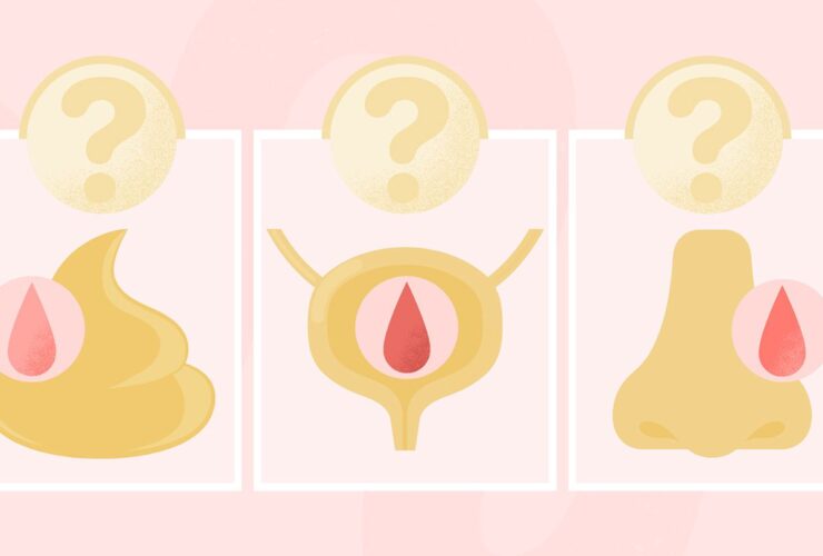 Is This Weird Bleeding a Sign of Cancer?