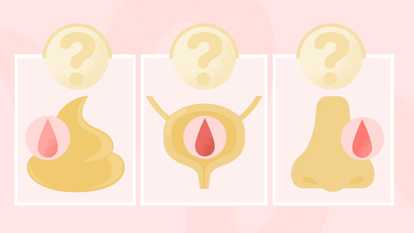 Is This Weird Bleeding a Sign of Cancer?