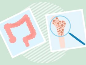 Crohn’s Disease and Osteoporosis: What’s the Connection?