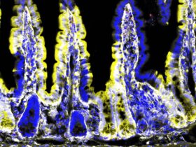 Divergent ILC3 responses to PDGF-D control mucosal immunity | Science Immunology