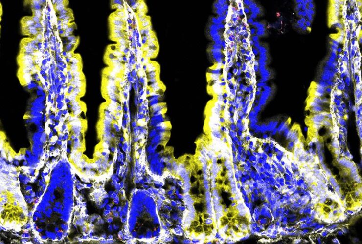 Divergent ILC3 responses to PDGF-D control mucosal immunity | Science Immunology