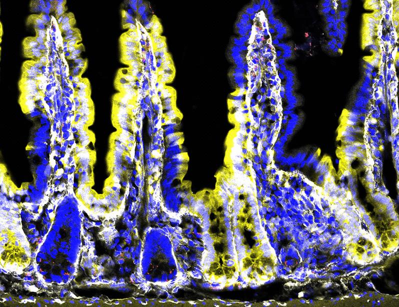 Divergent ILC3 responses to PDGF-D control mucosal immunity | Science Immunology