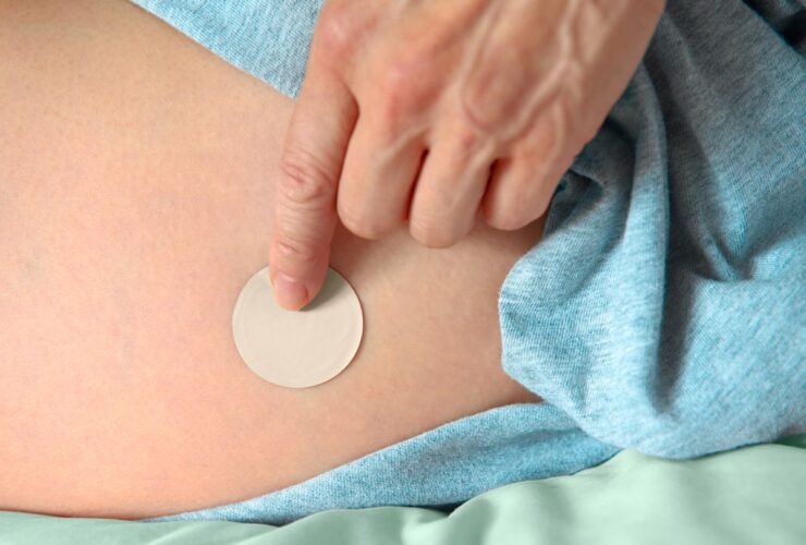 Estrogen Patches Are in Short Supply — Is There a Workaround?