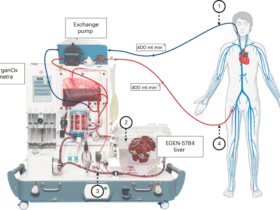 Extracorporeal cross-circulation with genetically modified pig livers in a human decedent model