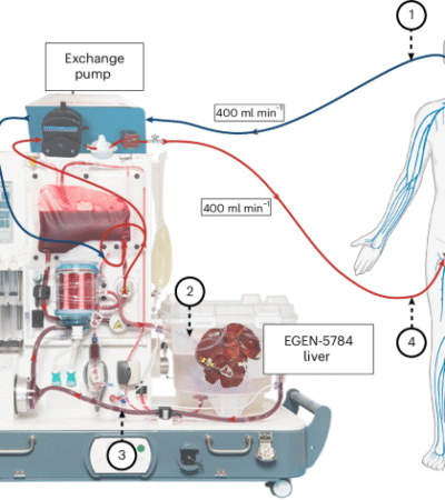 Extracorporeal cross-circulation with genetically modified pig livers in a human decedent model