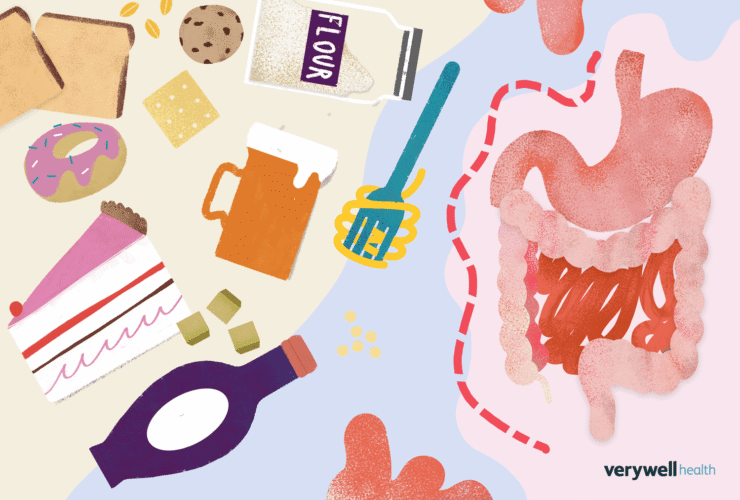 Gluten Intolerance Symptoms and Management