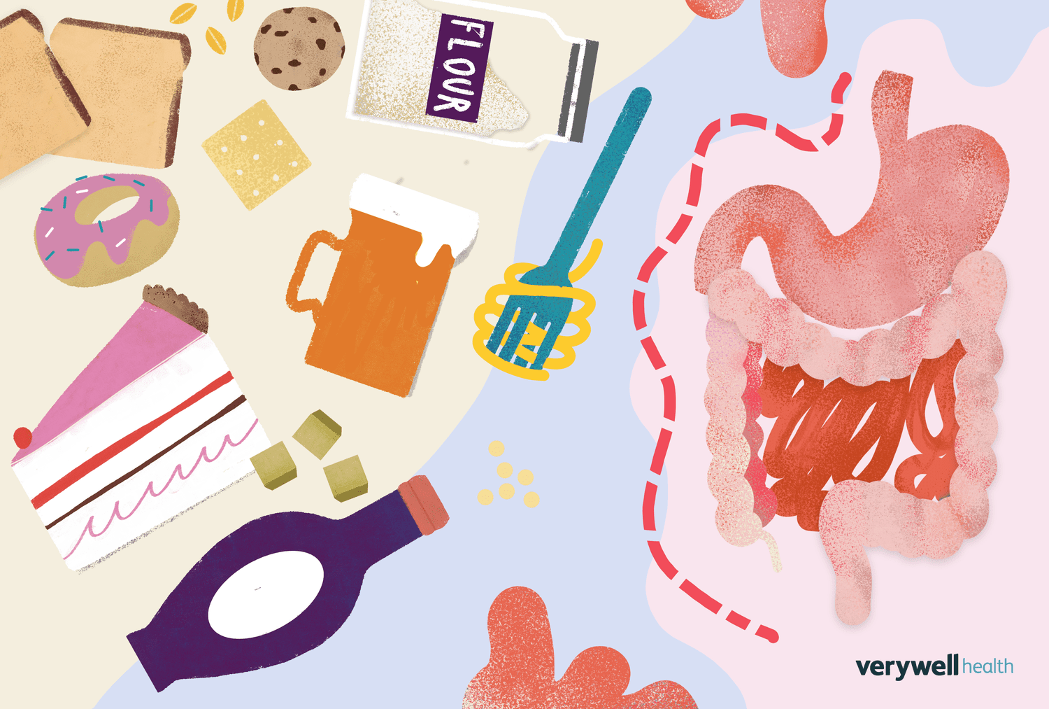 Gluten Intolerance Symptoms and Management