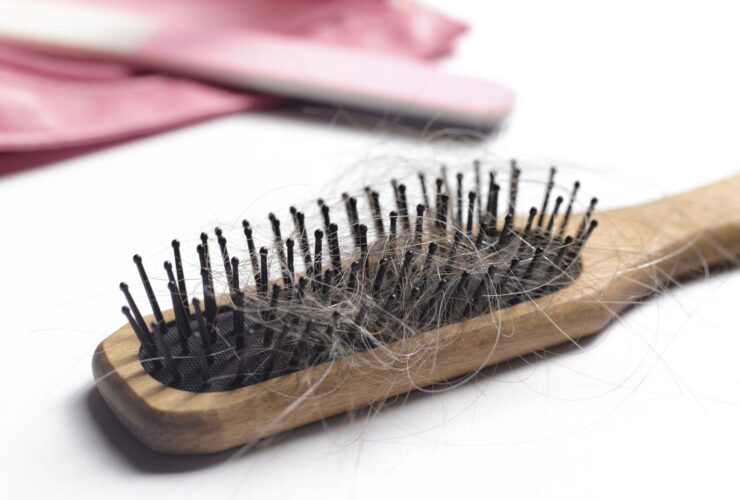 Hair Loss: Symptoms, Causes, and Treatment