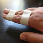 How to Buddy Tape a Finger at Home