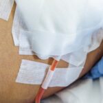 How to Care for Your Surgical Drain at Home