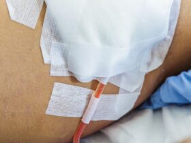 How to Care for Your Surgical Drain at Home