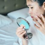 How to Recognize and Clear Up Fungal Acne