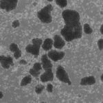 Human LFA-1 governs T cell immune surveillance of the skin | Science Immunology