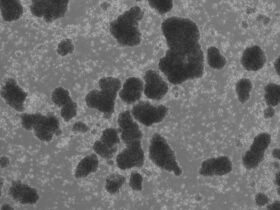 Human LFA-1 governs T cell immune surveillance of the skin | Science Immunology