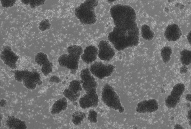 Human LFA-1 governs T cell immune surveillance of the skin | Science Immunology