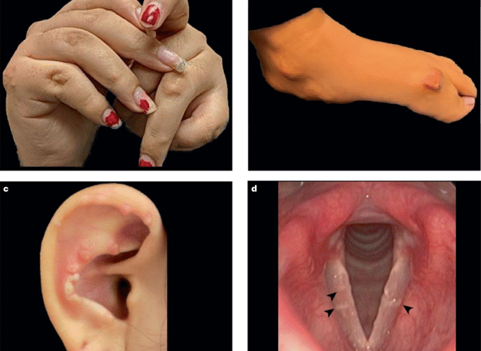 Metabolic masqueraders of paediatric and adult rheumatic diseases