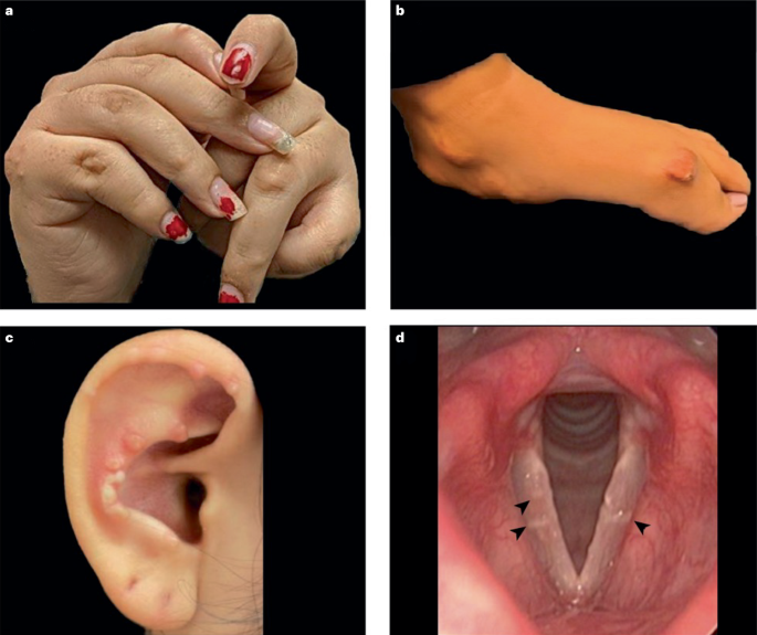 Metabolic masqueraders of paediatric and adult rheumatic diseases