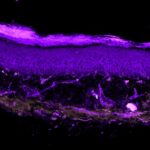 Monocyte-derived IL-10 drives sex differences in pain duration | Science Immunology