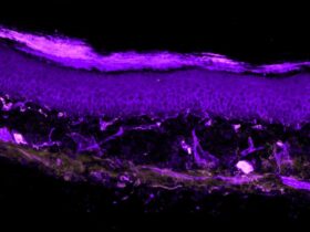 Monocyte-derived IL-10 drives sex differences in pain duration | Science Immunology