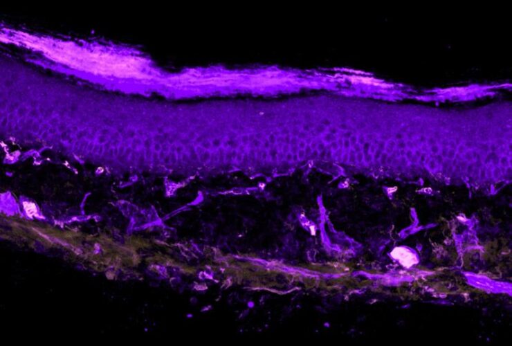 Monocyte-derived IL-10 drives sex differences in pain duration | Science Immunology