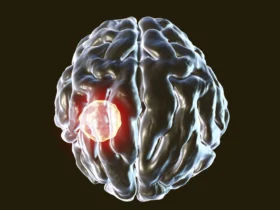 One in three people carry this brain parasite but the body has a kill switch