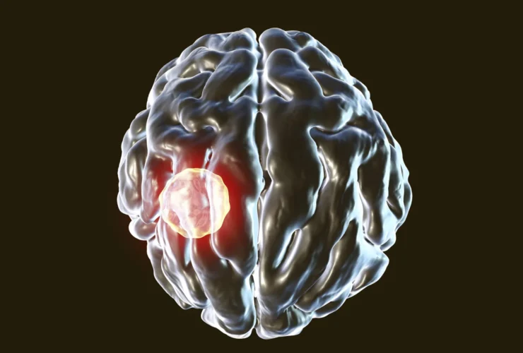 One in three people carry this brain parasite but the body has a kill switch