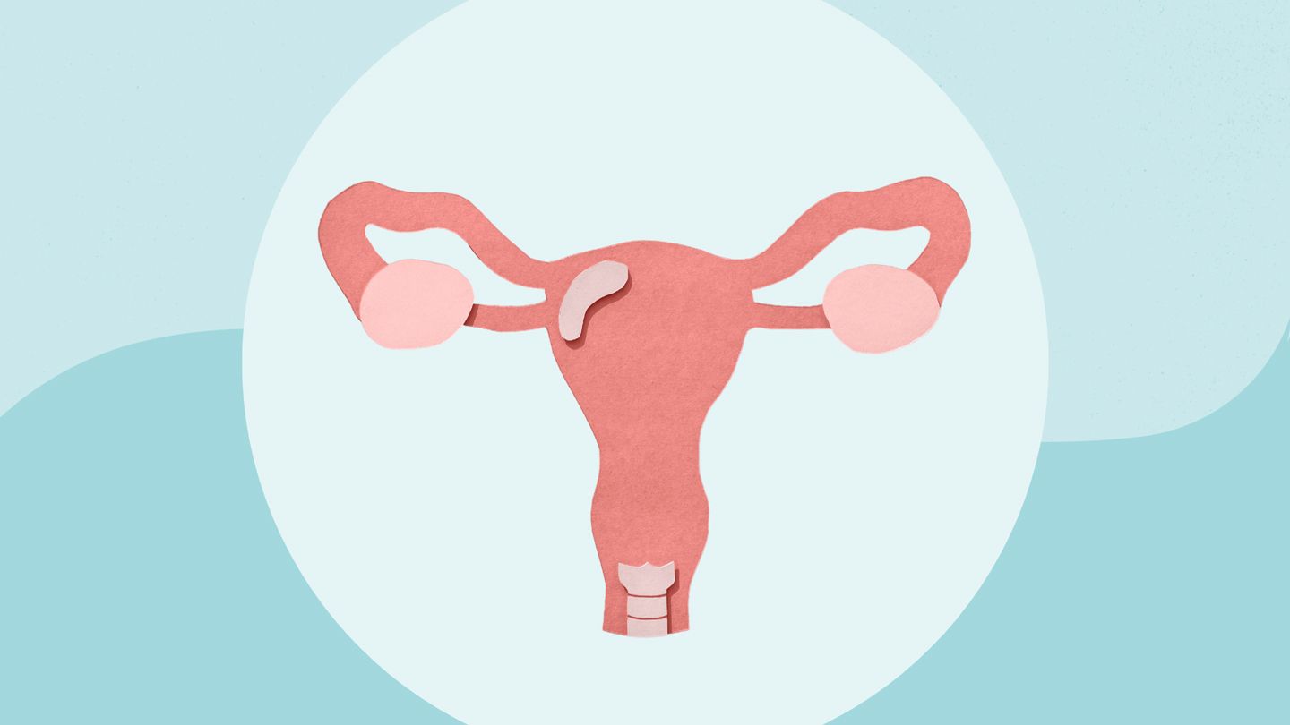 6 Ovarian Cancer Myths to Stop Believing Immediately