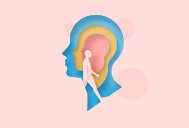 Multiple Sclerosis and Precision Medicine