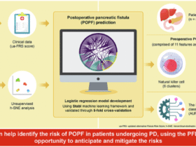 Preoperative lymphocyte signature predicts pancreatic fistula after pancreatoduodenectomy