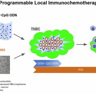 Programmable local immunochemotherapy for triple-negative breast cancer via spatiotemporally controlled release of CpG oligodeoxynucleotides, gemcitabine, and paclitaxel