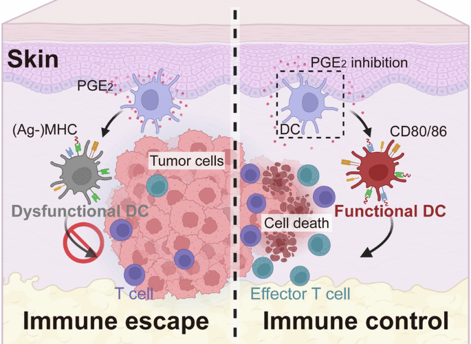 Prostaglandin E2 induces dendritic cell dysfunction in skin involvement of breast cancer