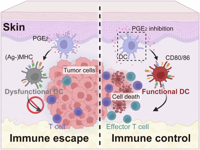 Prostaglandin E2 induces dendritic cell dysfunction in skin involvement of breast cancer